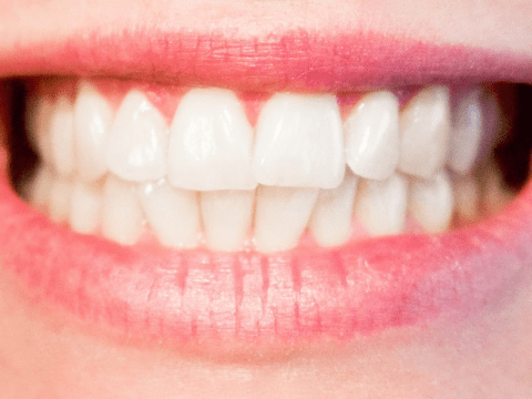 Dental Implants & Other Procedures for the Perfect Smile woman's teeth