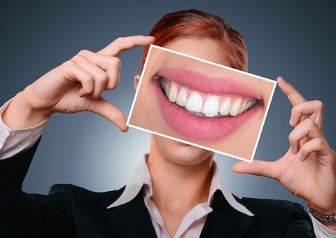 Top Advantages of Using Home Teeth Whitening Kits whitened teeth